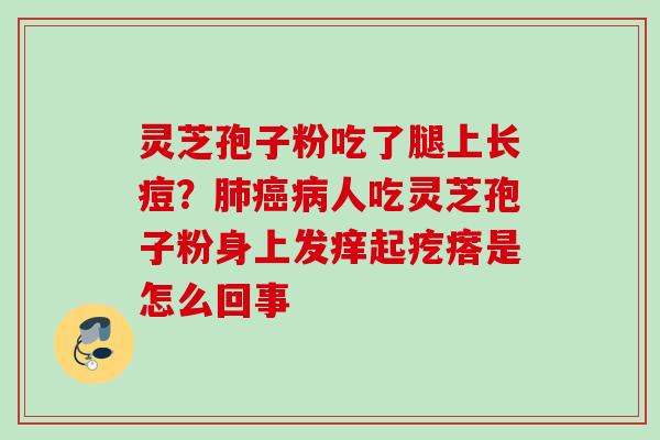 灵芝孢子粉吃了腿上长痘？人吃灵芝孢子粉身上发痒起疙瘩是怎么回事