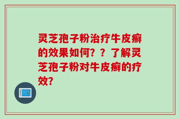 灵芝孢子粉治疗牛皮癣的效果如何??了解灵芝孢子粉对牛皮癣的疗效?