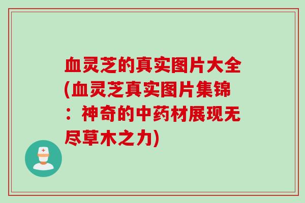 血灵芝的真实图片大全(血灵芝真实图片集锦：神奇的中药材展现无尽草木之力)