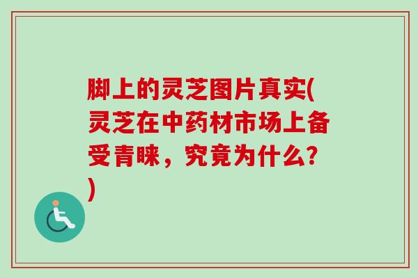 脚上的灵芝图片真实(灵芝在中药材市场上备受青睐，究竟为什么？)